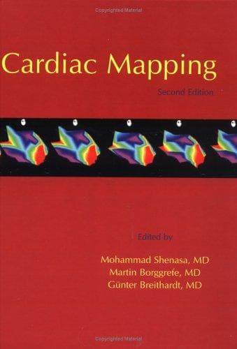 Tapa de Cardiac mapping