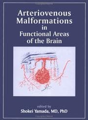 Tapa de Arteriovenous malformations in functional areas of the brain