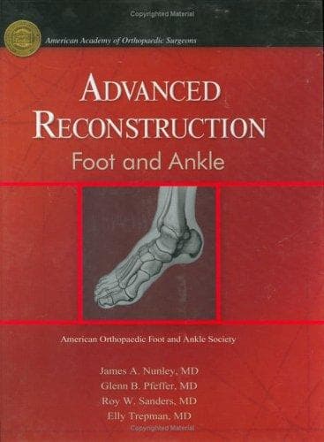 Tapa de Advanced Reconstruction Foot & Ankle