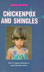 Tapa de Chickenpox and shingles