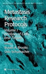 Tapa de Metastasis research protocols