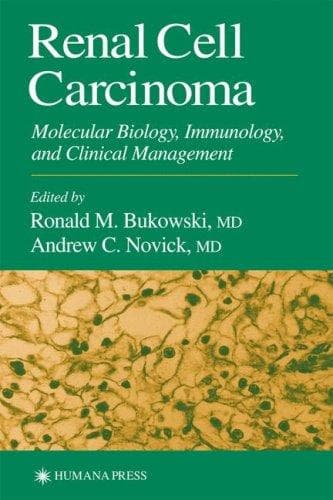 Tapa de Renal cell carcinoma