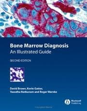 Tapa de Bone marrow diagnosis