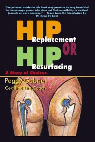 Tapa de Hip Replacement or Hip Resurfacing