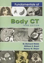 Tapa de Fundamentals of body CT