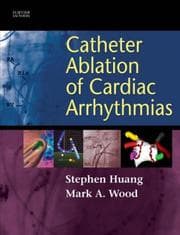 Tapa de Catheter ablation for cardiac arrhythmias