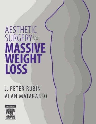 Tapa de Aesthetic surgery after massive weight loss