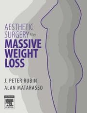 Tapa de Aesthetic surgery after massive weight loss