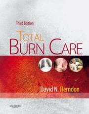 Tapa de Total Burn Care