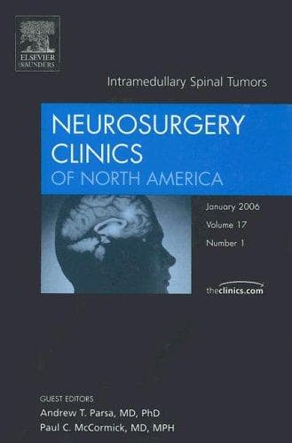 Tapa de Intramedullary Spinal Tumors