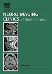 Tapa de Neuroimaging:3.0t vs. 1.5t, An Issue of Neuroimaging Clinics (The Clinics: Radiology)