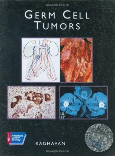 Tapa de Germ cell tumors