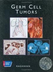 Tapa de Germ cell tumors