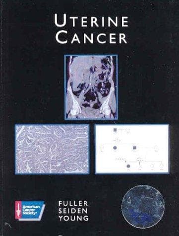 Tapa de Uterine cancer