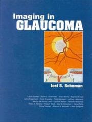 Tapa de Imaging in glaucoma