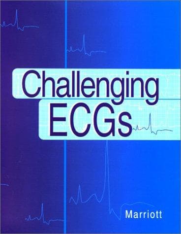 Tapa de Challenging ECGs