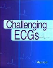 Tapa de Challenging ECGs