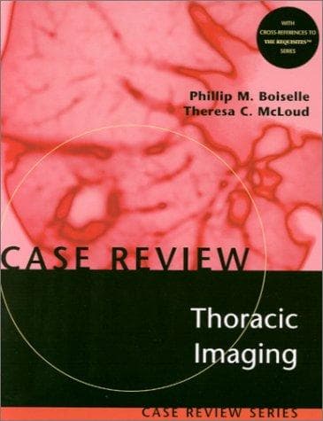 Tapa de Thoracic imaging