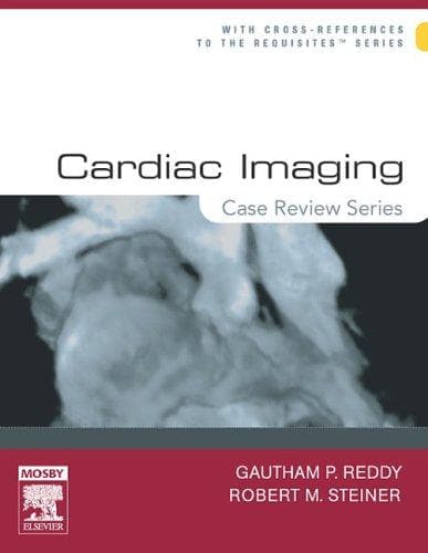 Tapa de Cardiac imaging