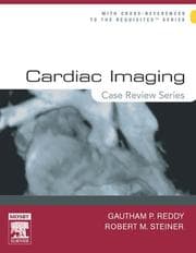 Tapa de Cardiac imaging