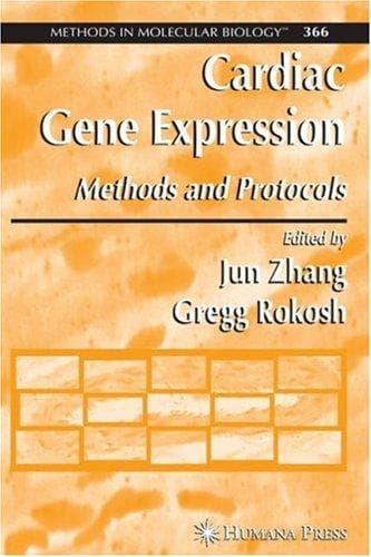 Tapa de Cardiac gene expression