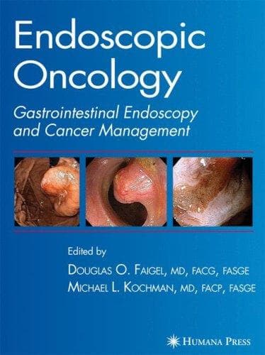 Tapa de Endoscopic Oncology