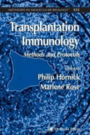 Tapa de Transplantation Immunology