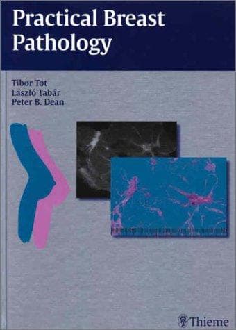 Tapa de Practical Breast Pathology