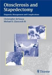 Tapa de Otosclerosis and stapedectomy