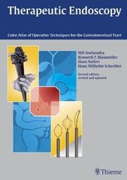 Tapa de Therapeutic endoscopy