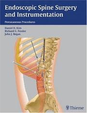 Tapa de Endoscopic spine surgery and instrumentation