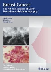Tapa de Breast Cancer: The Art And Science Of Early Detection With Mamography