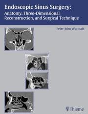 Tapa de Endoscopic sinus surgery