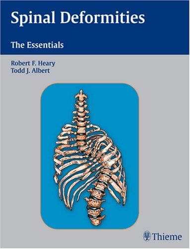 Tapa de Spinal deformities