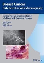 Tapa de Casting Type Calcifications: Sign of a Subtype With Deceptive Features (Breast Cancer: Early Detection With Mammography)