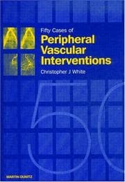 Tapa de Fifty Cases of Peripheral Vascular Interventions