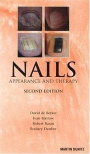 Tapa de Nails