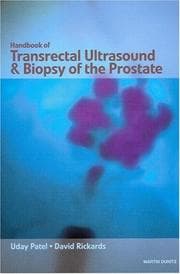 Tapa de Handbook of Transrectal Ultrasound and Biopsy of the Prostate