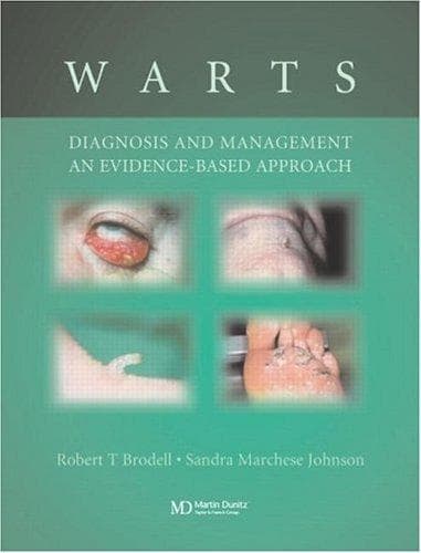 Tapa de Warts