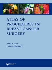 Tapa de Atlas of Procedures in Breast Cancer Surgery
