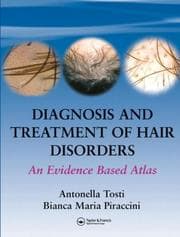 Tapa de Diagnosis and Treatment of Hair Disorders