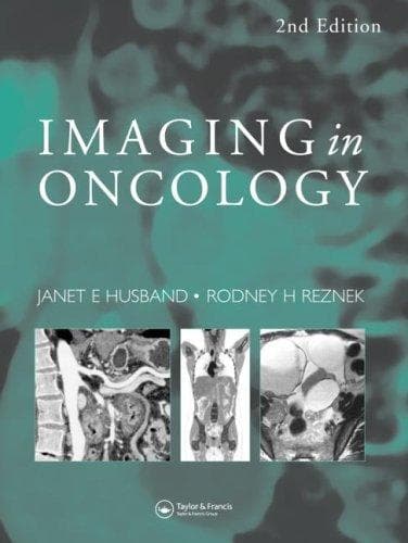 Tapa de Imaging in oncology