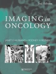 Tapa de Imaging in oncology