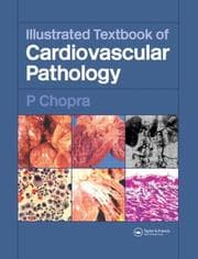 Tapa de ILLUSTRATED TEXTBOOK OF CARDIOVASCULAR PATHOLOGY