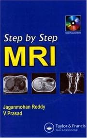 Tapa de Step by Step MRI