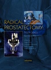 Tapa de Radical Prostatectomy