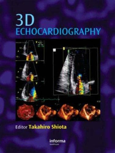 Tapa de 3D Echocardiography
