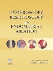 Tapa de Hysteroscopy, resectoscopy and endometrial ablation