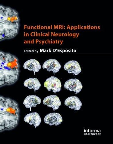 Tapa de Functional MRI