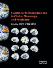 Tapa de Functional MRI